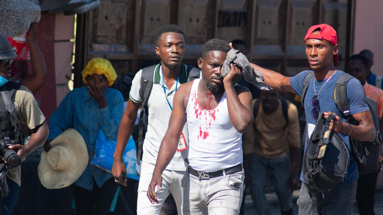 A journalist after he was reportedly hit by a tear gas canister. Picture: Clarens Siffroy/AFP