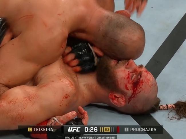 Bloody carnage in UFC fight of the year