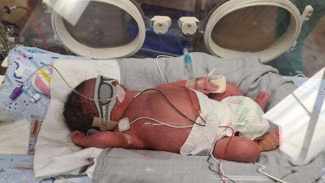 Thea was born prematurely and diagnosed with biliary atresia. Picture: supplied