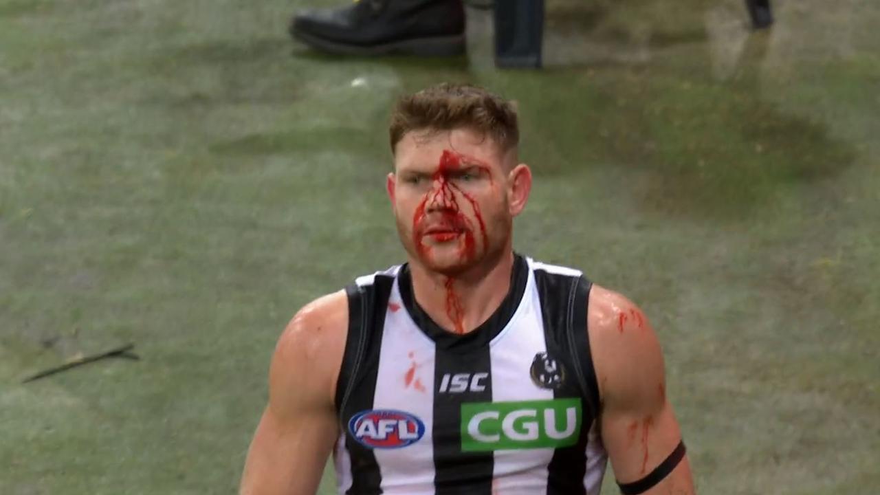 Blood was spilt and hearts were broken after Collingwood once again suffered a nailbiting defeat to the Greater Western Sydney Giants.