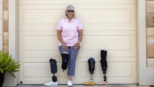 Road crash survivor Vivienne Duffett with her three prosthetic legs. Picture: Kelly Barnes