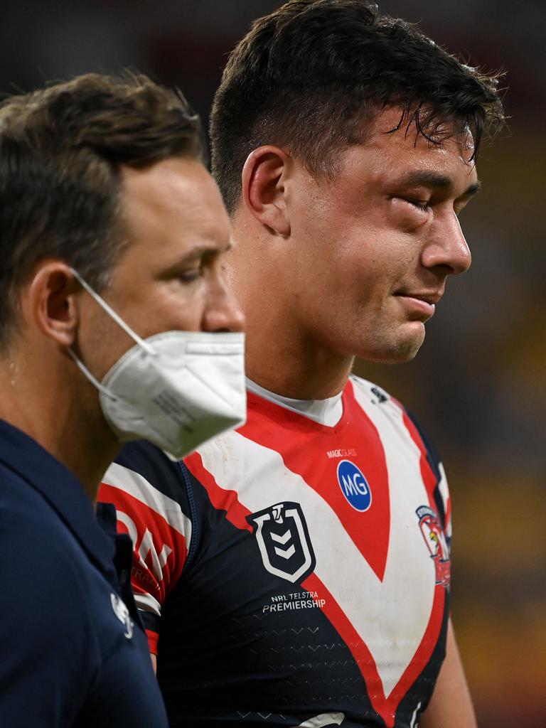 It was a pretty ugly injury. Photo: NRL PHOTOS