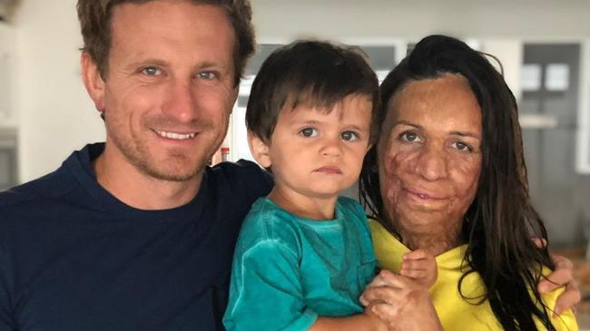 Turia Pitt with her partner Michael. Picture: Instagram