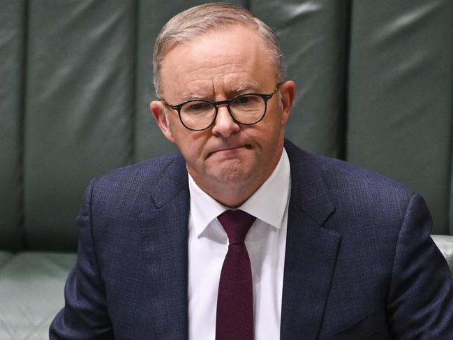 Albanese is a liar or dangerously ignorant on key details of his Voice. Picture: Getty