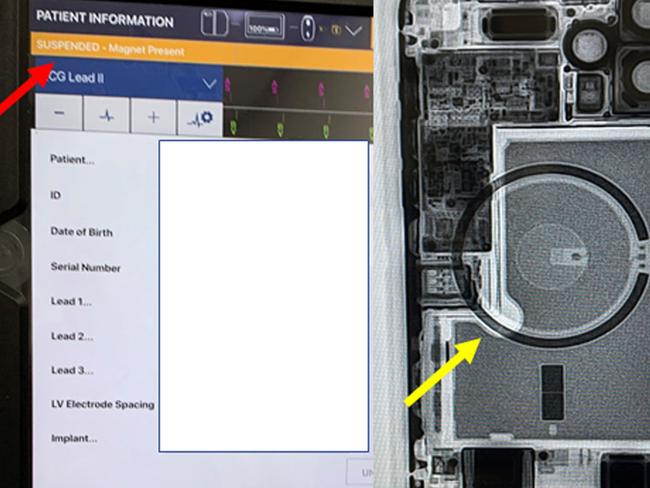 Doctors tested how the iPhone 12's new MagSafe capabilities impact on implanted medical devices.
