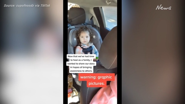 My toddler was mauled without warning or reason