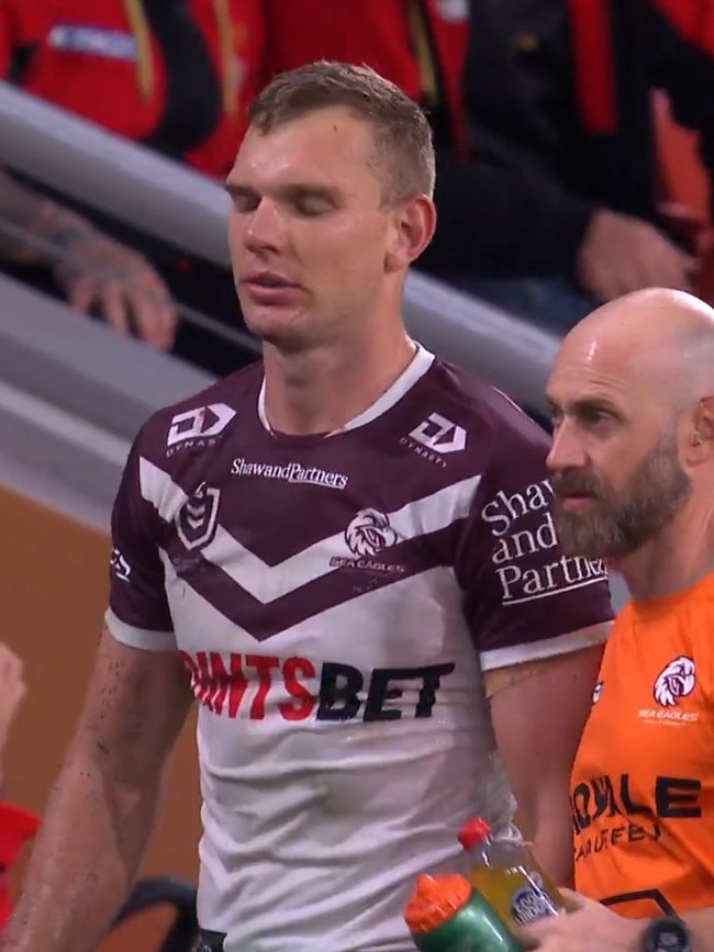 Trbojevic didn't look happy. Photo: Fox Sports