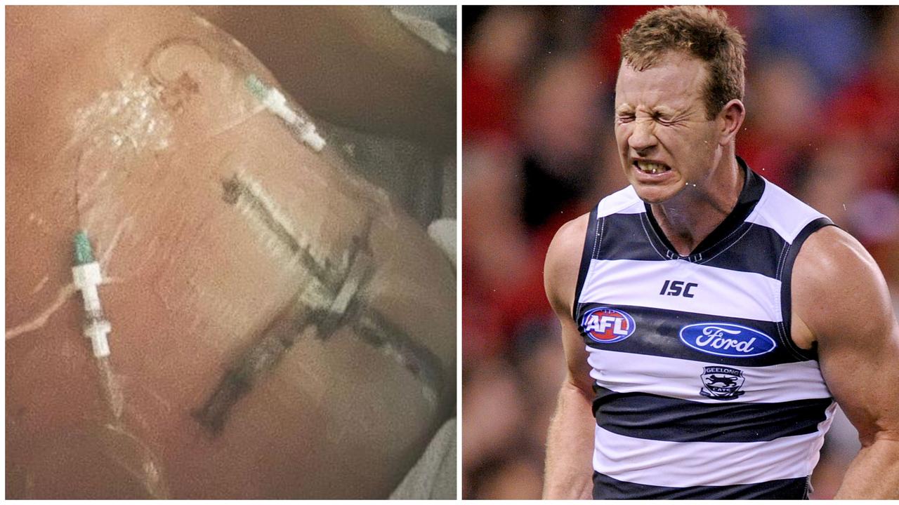 ‘No guarantees’: Cats legend Steve Johnson opens up on ‘freak’ stabbing