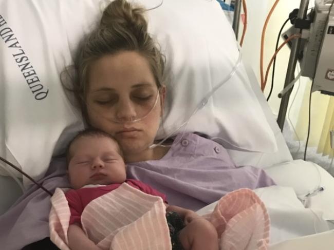 ‘Nightmare’: Mum’s $3m mega claim over horror infection after C-section