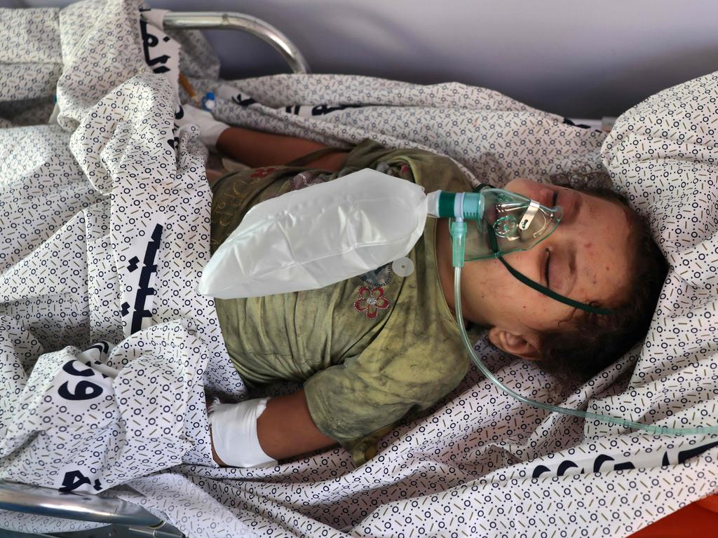 A Palestinian child, injured during an Israeli air strike, receives treament in Rafah, on the southern Gaza Strip. Picture: AFP