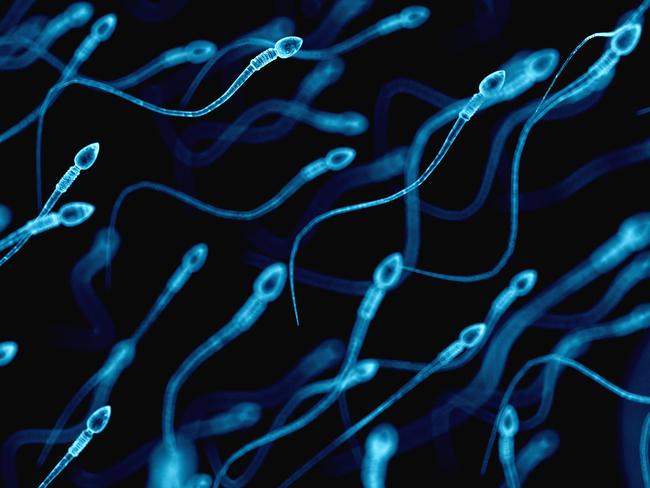 Human sperm, illustration.. Picture: Getty Images.