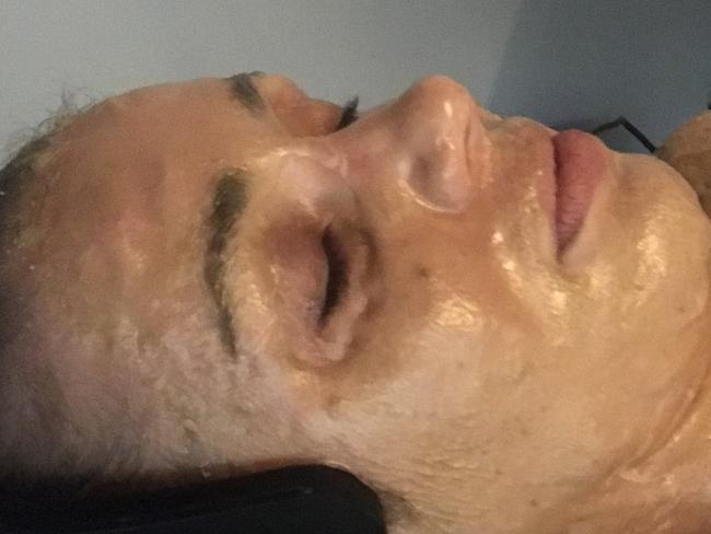 The 'Game of Thrones' facial will have you looking like an alien for a few minutes during treatment.