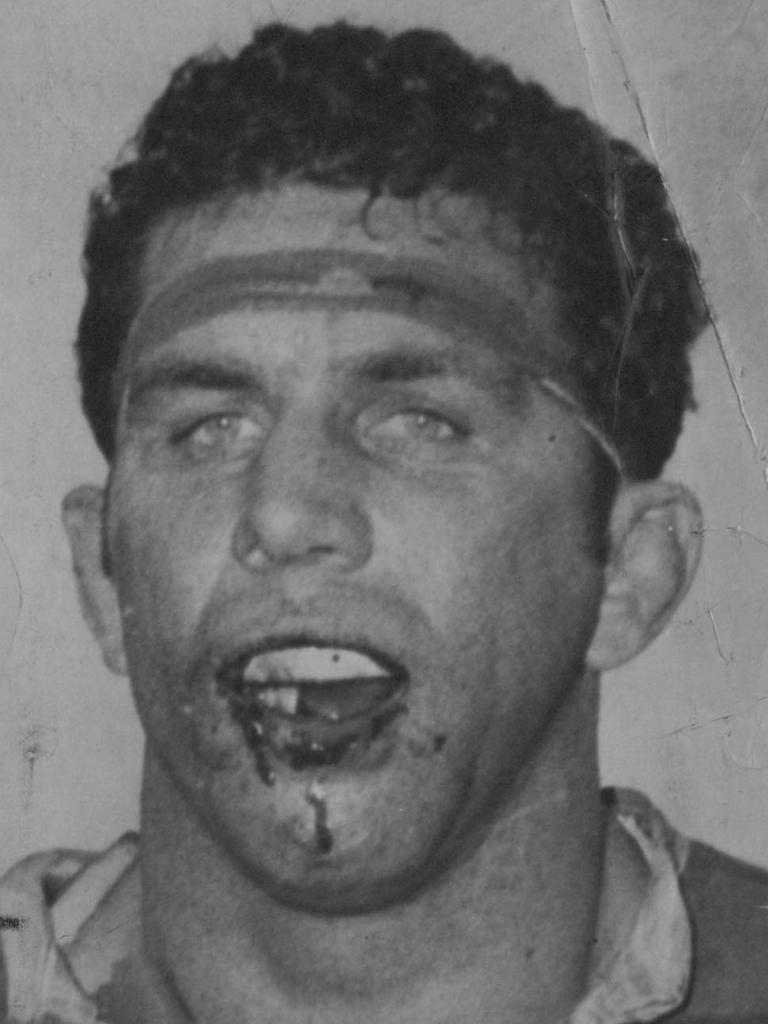 John Sattler had to push his badly broken jaw back in place to speak to reporters after the game.