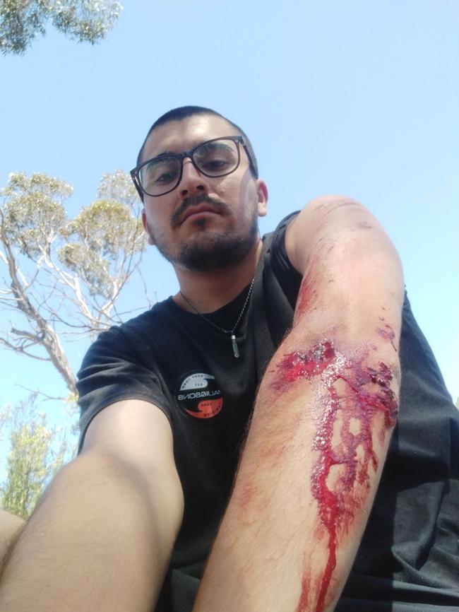 Chilean tourist Rodolfo Mendez five days after he crashed his car near Yalata Aboriginal community while driving across the Nullarbor.