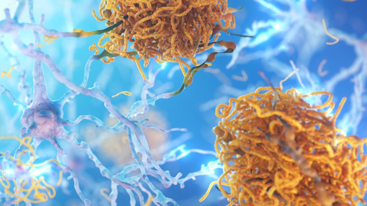 ‘Hope’: Huge leap in dementia treatment