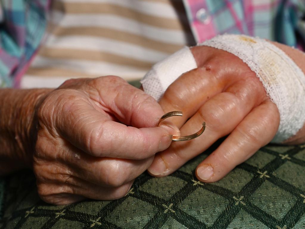 The ring after it was cut off. Picture: Josie Hayden