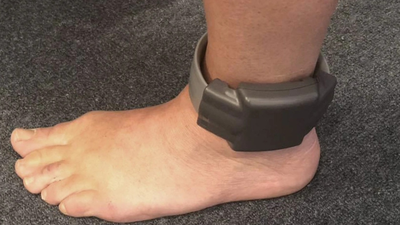 BailSafe Australia provided GPS ankle monitors for offenders. Picture: supplied