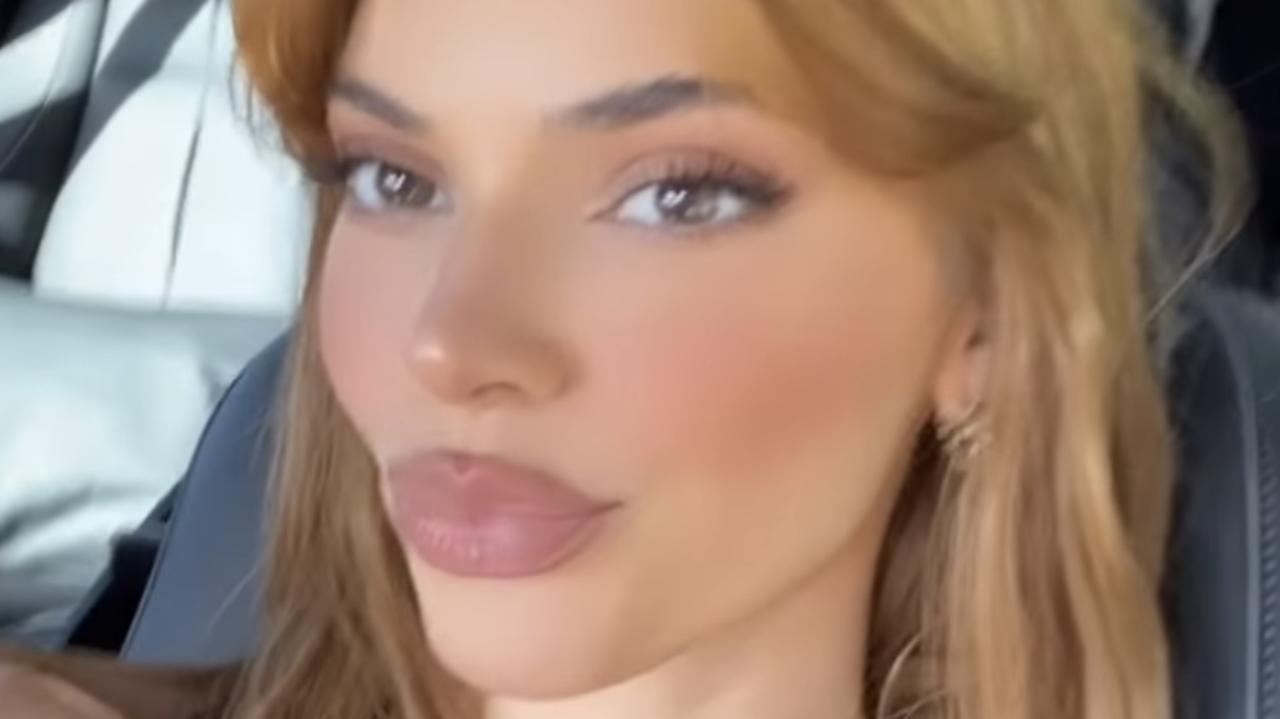 Kendall Jenner Plastic Surgery Model Shocks Fans With Much Larger Lips Photos Herald Sun