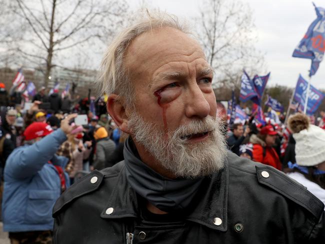 A man is seen bleeding outside the U.S. Capitol Building. Picture: Getty