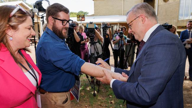 Prime Minister Anthony Albanese writes ‘NO CHANGE TO WA GST’ on a reporter’s arm during his visit to Perth on Monday. Picture: AAP