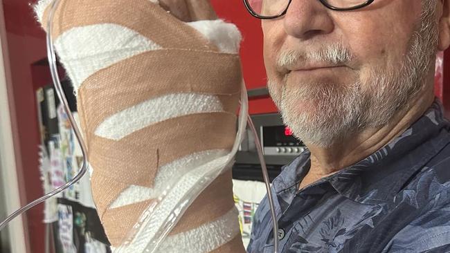 ‘See you around’: Gruesome injury forces Aussie icon to postpone Toowoomba gig