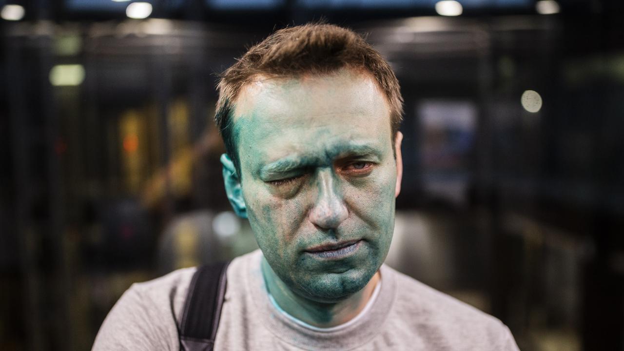 The Kremlin’s enemy No.1: ‘Navalny was in real pain.’