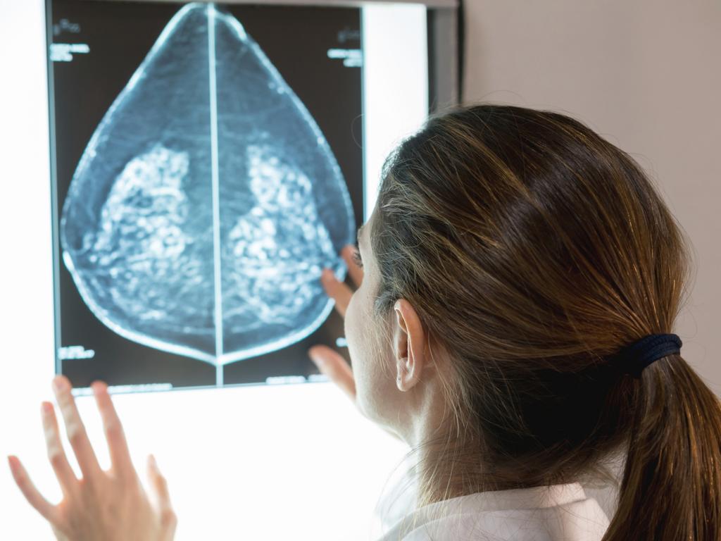 Young women were 70 per cent more likely to develop an early-onset cancer than young men