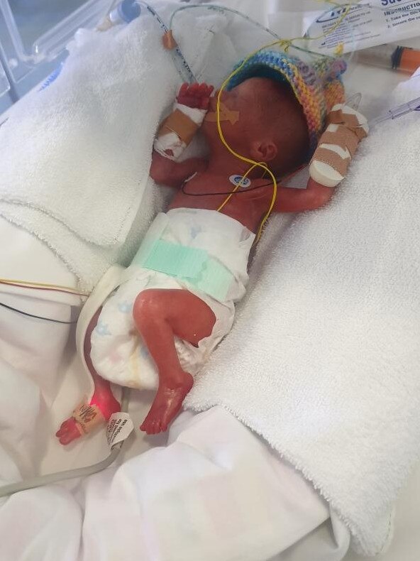 Skylah spent 100 days in hospital before finally being allowed home this week. Picture: Supplied