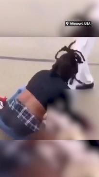 Brutally bashed teen by girl might not recover