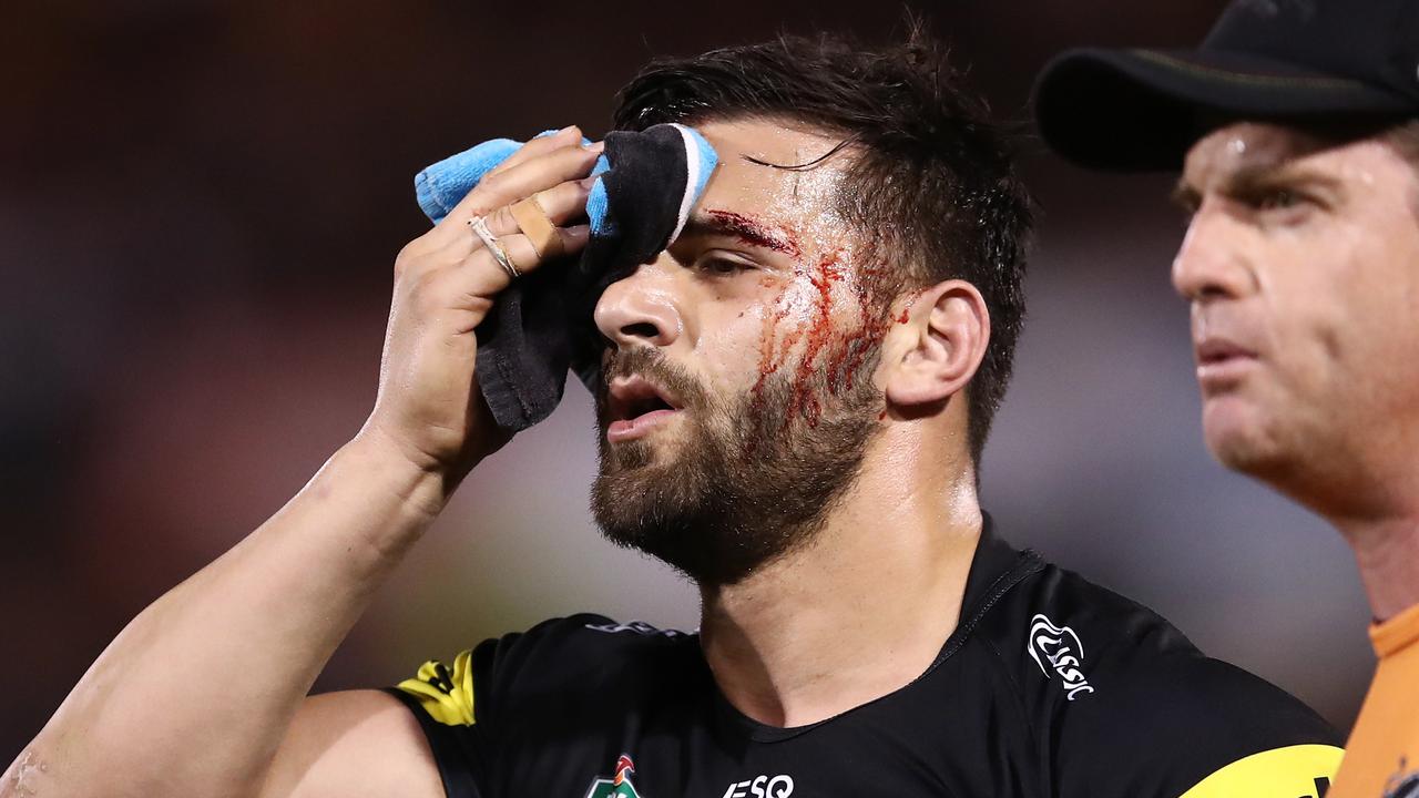 NRL casualty ward: Josh Mansour, Cameron Smith, Melbourne Storm injuries