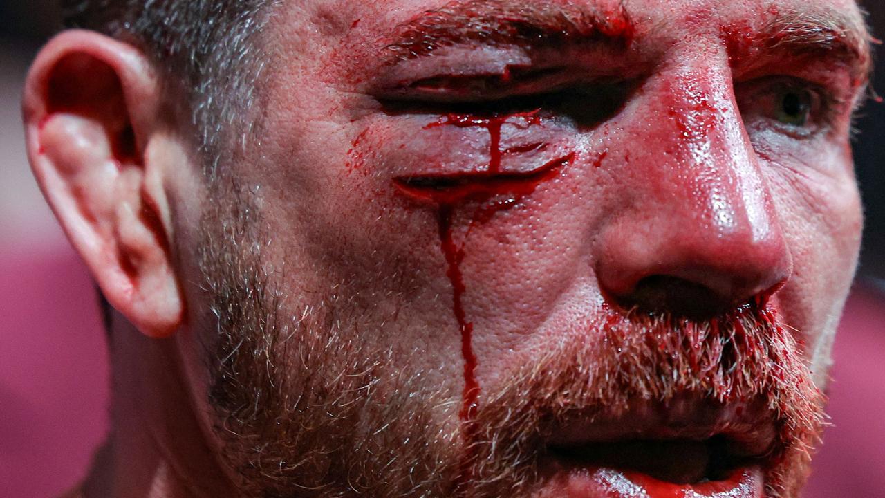 That’s a nasty cut. Photo: Carmen Mandato/Getty Images/AFP.