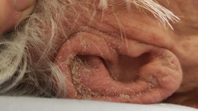 Kindred Living Annie Lockwood Court aged care facility was investigated by federal authorities after allegations of poor conditions and a scabies outbreak.