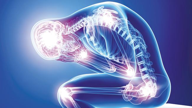 A breakthrough in rheumatoid arthritis may be just around the corner. Picture: Supplied