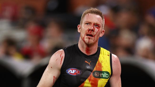 Jack Riewoldt had blood gushing from his head after his head was accidentally clipped, but he played on. Picture: Michael Klein