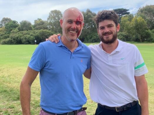 Star leaves golfer a bloody mess in ugly scene