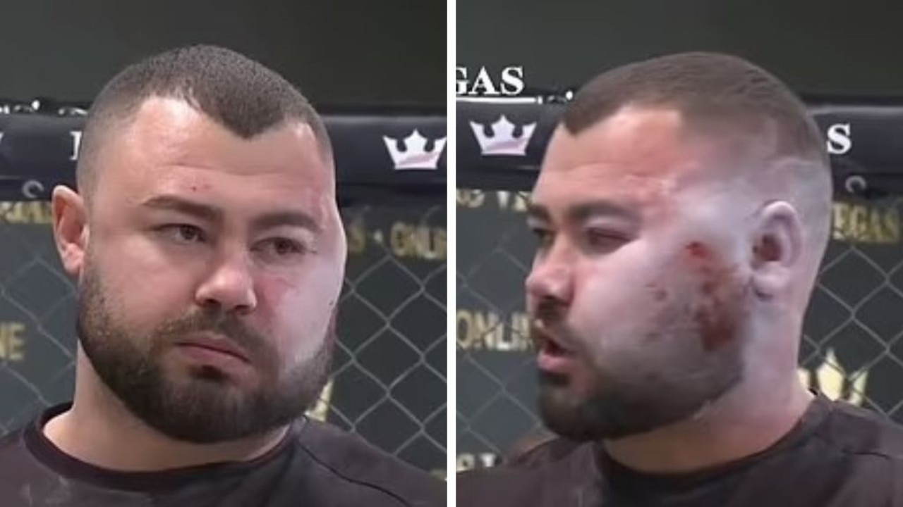 Slap Fighting Fighters Face Left Disfigured Video Sorin Comsa Reaction Dana White Nt News 