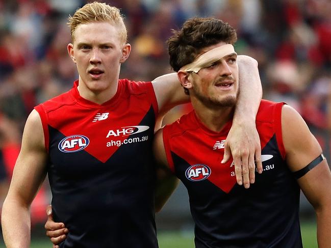 MELBOURNE, AUSTRALIA - APRIL 02: Clayton Oliver (left) and Angus Brayshaw of the Demons celebrate during the 2017 AFL round 02 match between the Melbourne Demons and the Carlton Blues at the Melbourne Cricket Ground on April 02, 2017 in Melbourne, Australia. (Photo by Michael Willson/AFL Media/Getty Images)