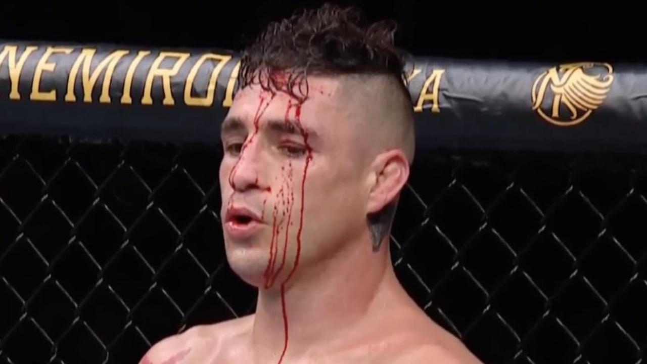 Diego Sanchez took the disqualification win over Michael Pereira.