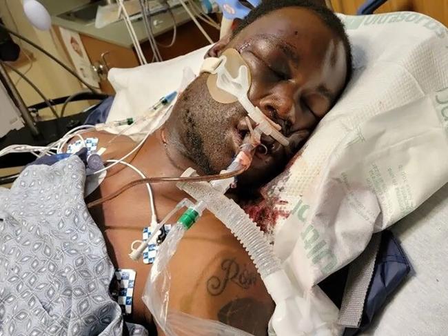 Tyre Nichols succumbed to his injuries, days after he was beaten by five police officers. Picture: Supplied