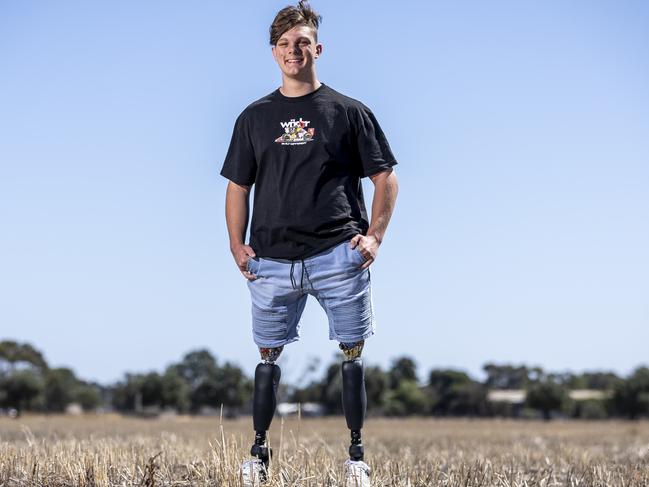 Ted says the Royal Children’s Hospital has “done so much for me”. Picture: Jake Nowakowski