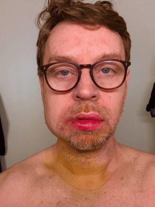Darren Hayes has revealed he nearly died after suffering a “terrible accident”. Picture: Instagram/darrenhayes