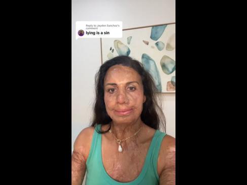 Turia Pitt fires back at cruel social media troll