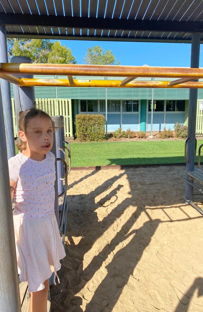 Child Injured On Beaconsfield State School Monkey Bars | Gold Coast ...