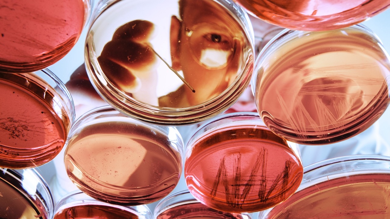 Clever Culture’s lab tech turns heads