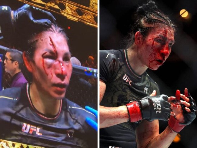 Irene Aldana's brutal injuries at UFC 306. Photos: AFP/Fox Sports