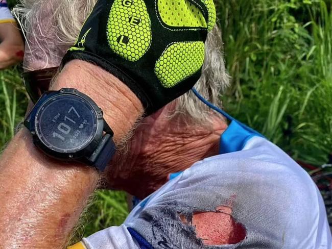 Sir Richard Branson's latest bike crash at a charity event in the British Virgin Islands. Picture: Instagram/Sir Richard Branson