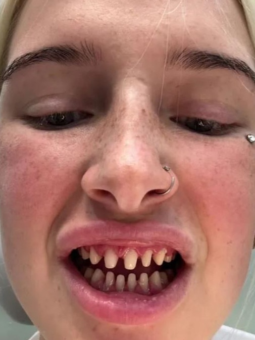 She urged people to take note of her warning, and not get their teeth done in Turkey. Picture: TikTok/@nikeishalouise