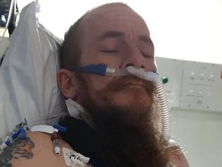 Vagabonds biker broke 14 bones, can’t walk or eat