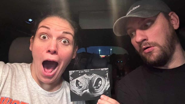 Kelsey Hatcher is pregnant in both of her two uteruses at once. Picture: GoFundMe.