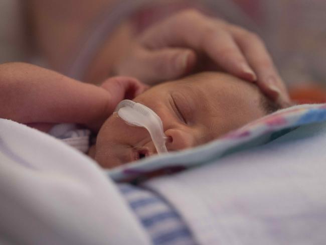 25-11-2024 Barwon Health Foundation is launching its Wish Upon A Star Christmas Appeal that helps parents like Tyla and Dale Anderson who have just welcomed their son Hamish, born prematurely at 31 weeks and is currently receiving care at Barwon Health's Special Care Nursery. Picture: Brad Fleet